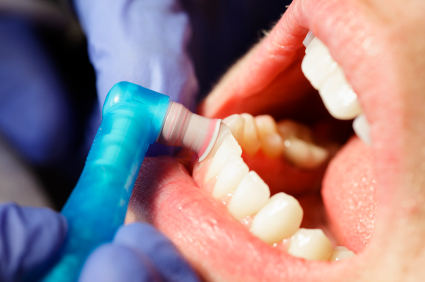 Should You See a Dentist for Your Dental Cleaning Treatment, Wilton Manors?