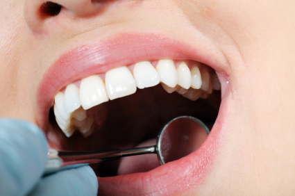 How Do Extractions Work in Teeth Treatment?