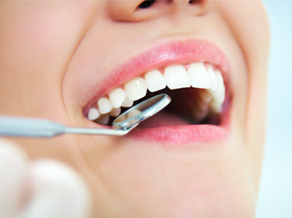 Components of Preventive Dental Care in Wilton Manors